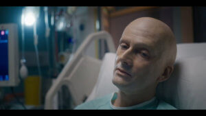 A man with no hair laying in a hospital bed